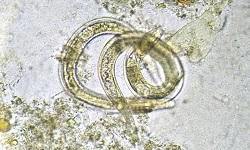 Strongyloides stercoralis